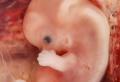 Intrauterini razvoj fetusa po sedmicama