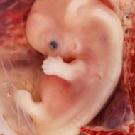 Desenvolvimento intrauterino do feto por semana